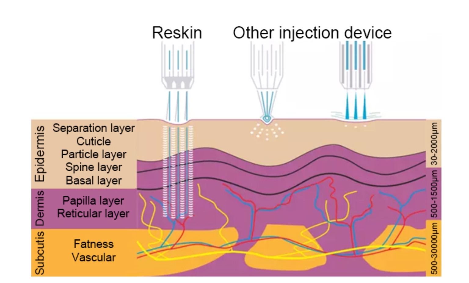 reskin